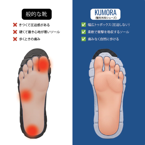KUMORA Pro – 一日中快適＆痛みゼロのベアフットシューズ